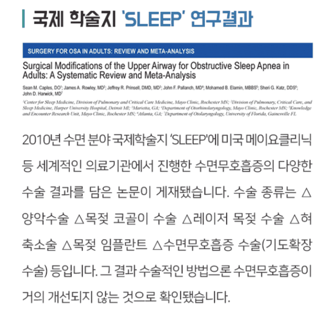 수면무호흡과 코골이 수술 1년 후, 효과와 부작용에 대한 진솔한 후기와 조언